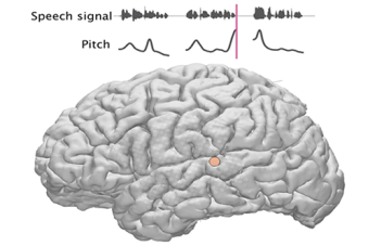 Picture of one electrode on the brain showing a response to a pitch contour in speech.