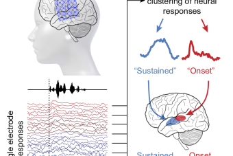 Graphical abstract showing schematic of electrocorticography recording setup, neural responses to speech, and unsupervised clustering of these neural responses to reveal a posterior onset and an anterior sustained area of superior temporal gyrus.